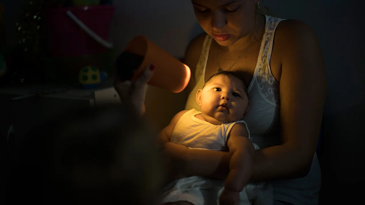 A baby born with microcephaly – stunted growth of brain triggered by the Zika virus in Brazil. (Photo: AP)