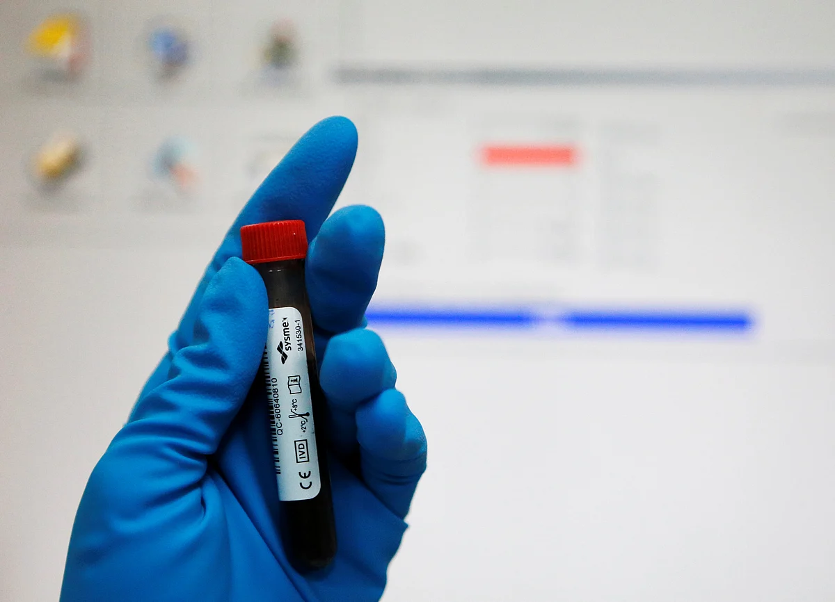 A technician holds a test tube with a blood sample at the Russian anti-doping laboratory in Moscow. (Photo: Reuters)