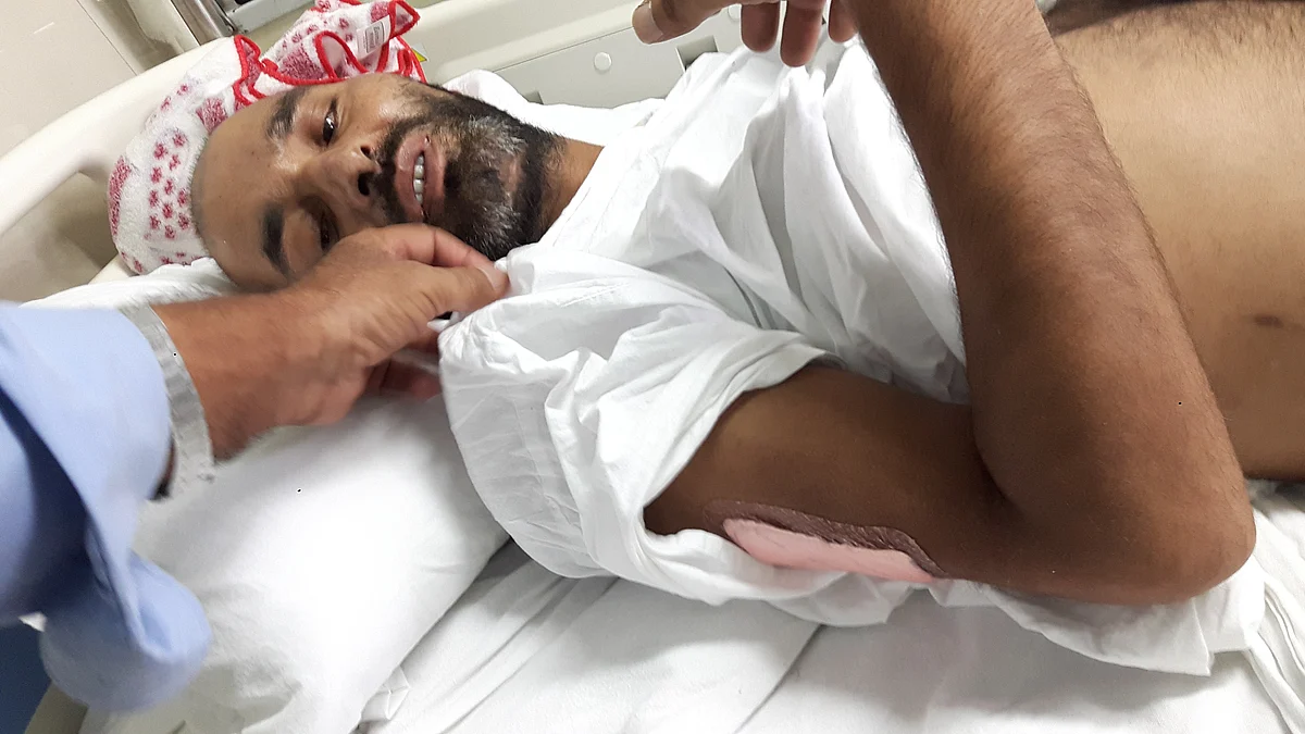 Khursheed was hit with 8 bullets in his waist, legs and shoulder. (Photo: Poonam Agarwal/<b>The Quint</b>)