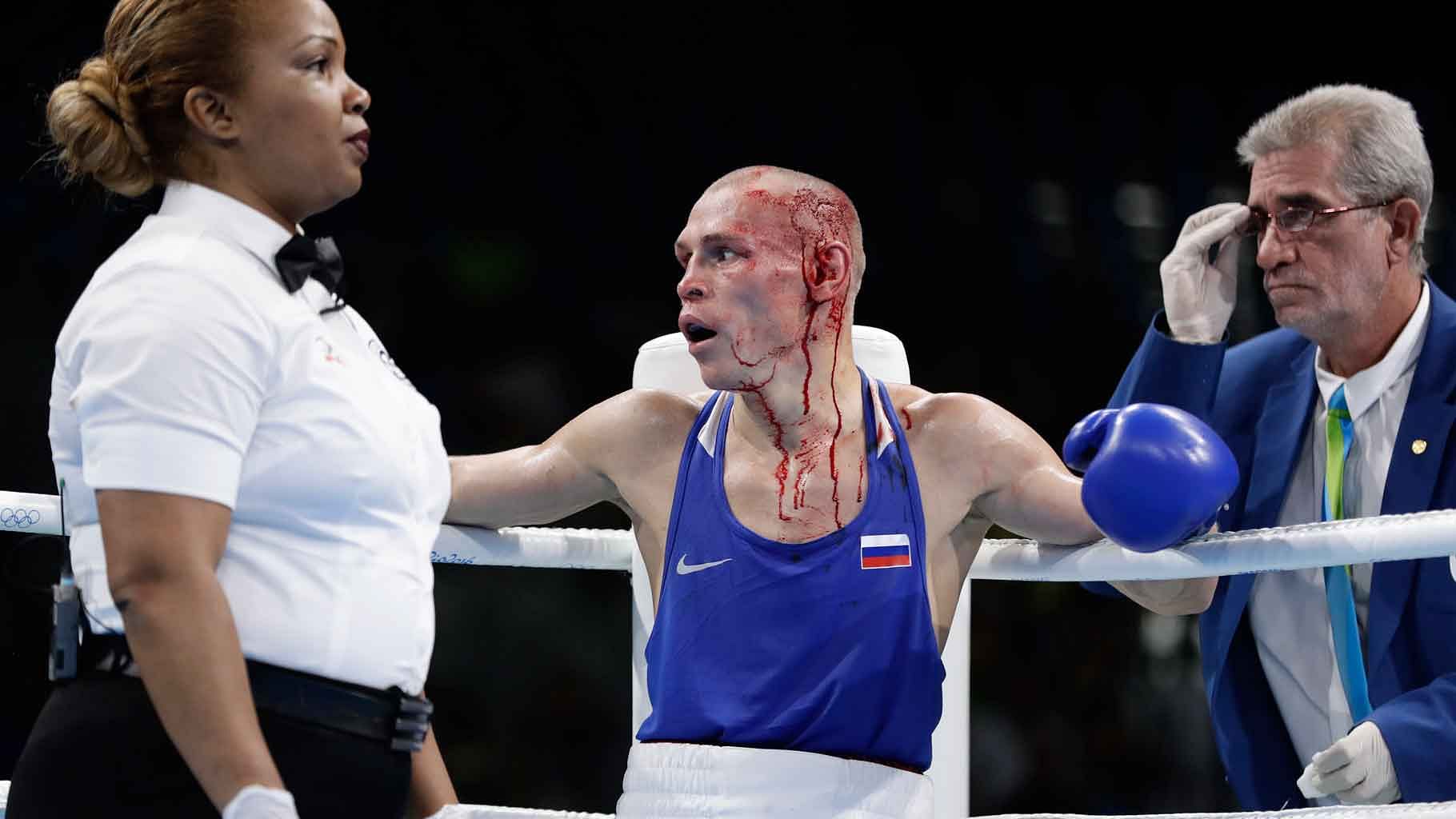  Referee stops the fight to have Russia’s Nikitin Vladimir’s cuts treated as Vladimir fights Vanuatu’s Boe Warawara during a men’s bantamweight 56-kg preliminary boxing match at the 2016 Summer Olympics in Rio de Janeiro, Brazil. (Photo: AP)