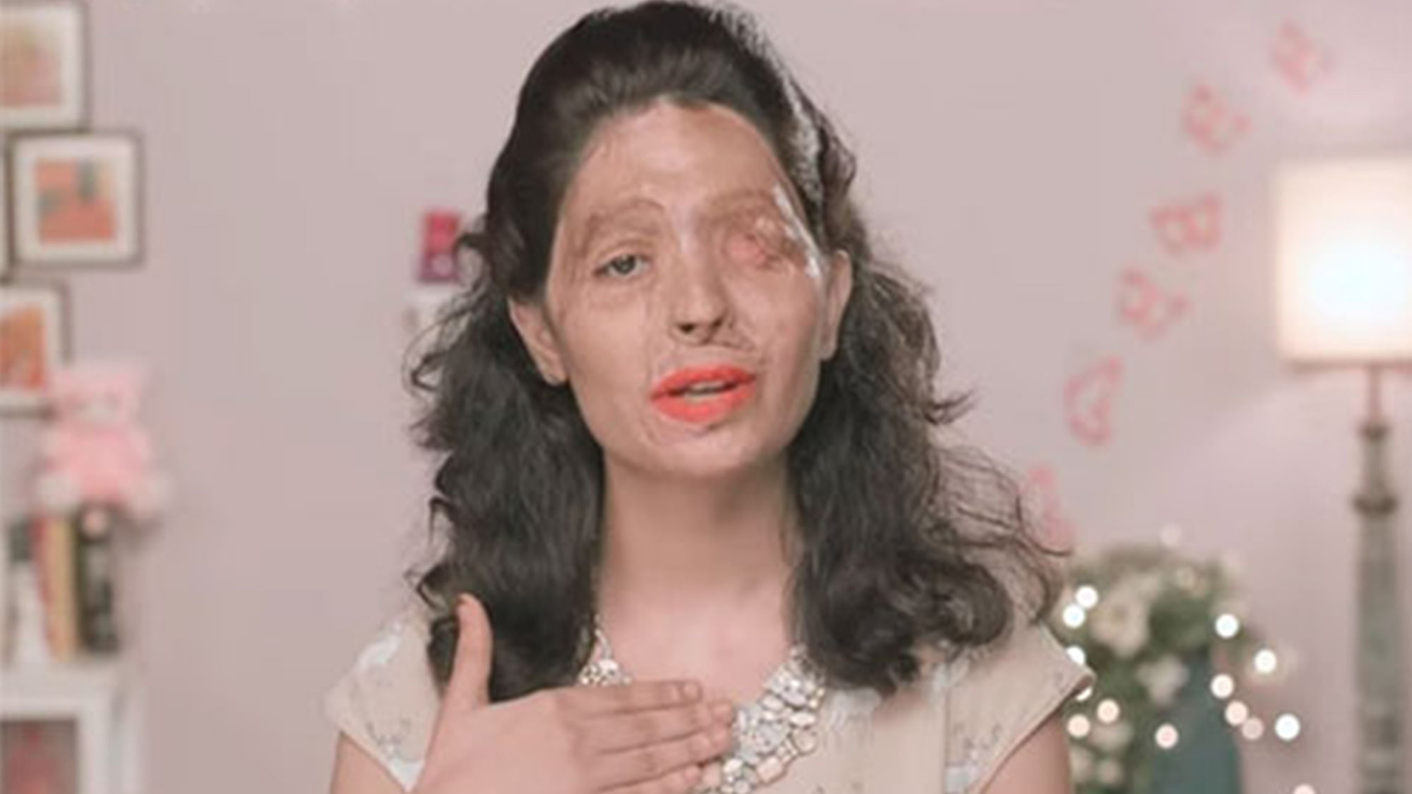 Fashion brand FTL Moda has asked acid attack victim Reshma Qureshi to walk the ramp for them at the New York Fashion Week in September. (Photo: Make Love Not Scars)