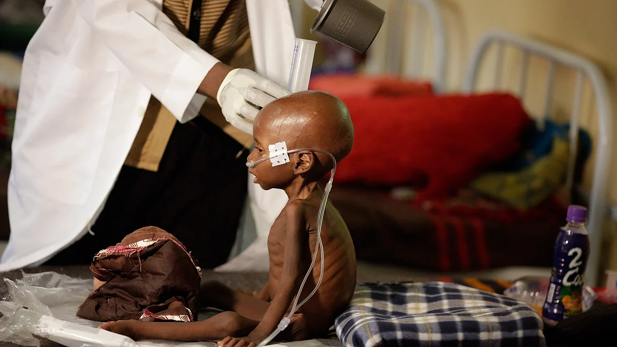 A malnourished child receives heathcare at a feeding centre run by Doctors Without Borders in Maiduguri Nigeria. (Photo: AP)