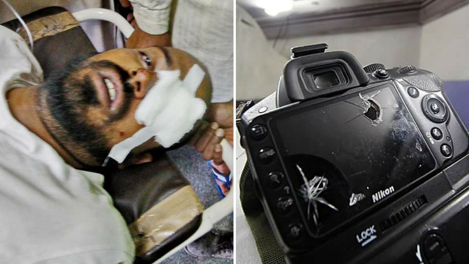 

Zuhaib, a photo-journalist who was targeted with pellets in Kashmir. (Provided to <b>The Quint</b> by Irfan Quraishi)