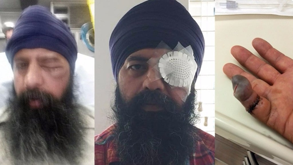‘56 White Males’ Assault USBased Sikh Man, Cut His Hair