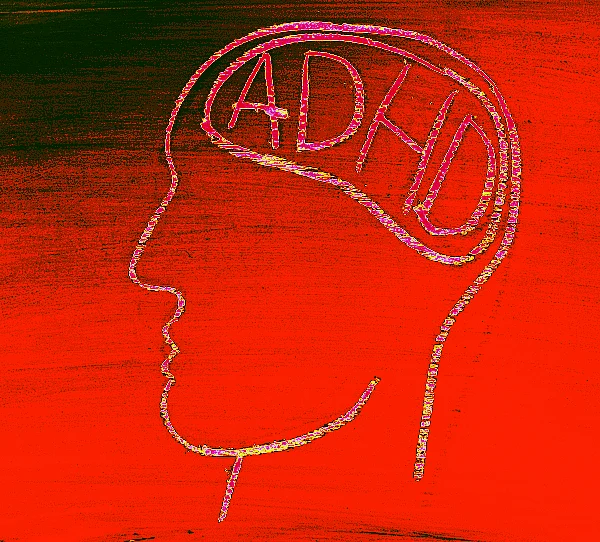 Lifestyle overhaul is integral to effectively managing ADHD because no medication will be able to pacify your brain cells if you keep feeding it alcohol, caffeine or give it a sugar high. (Photo: iStock altered by <b>The Quint</b>)