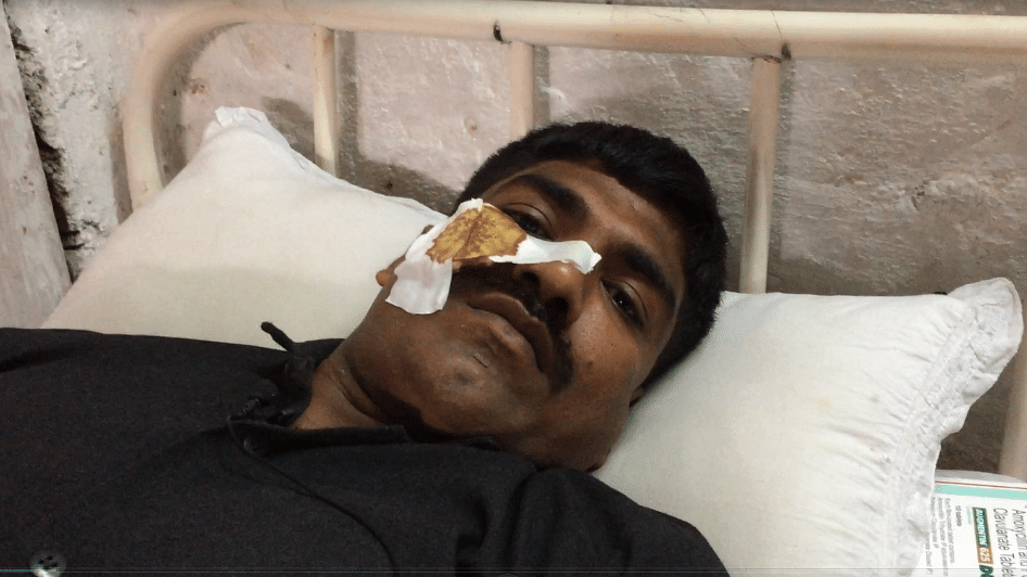 P Shivaji, CRPF jawan who lost one eye in stone-pelting incident in Kashmir. (Photo: <b>The Quint</b>/Poonam Agarwal)