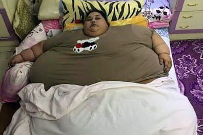 Mumbai-based bariatric surgeon Dr Lakdawala has also agreed to treat Eman Ahmed, who weighs 500 kg, for free. 