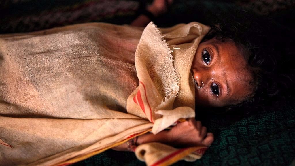 India is home to 40 Million stunted children, the largest number in the world. (Photo: Reuters)