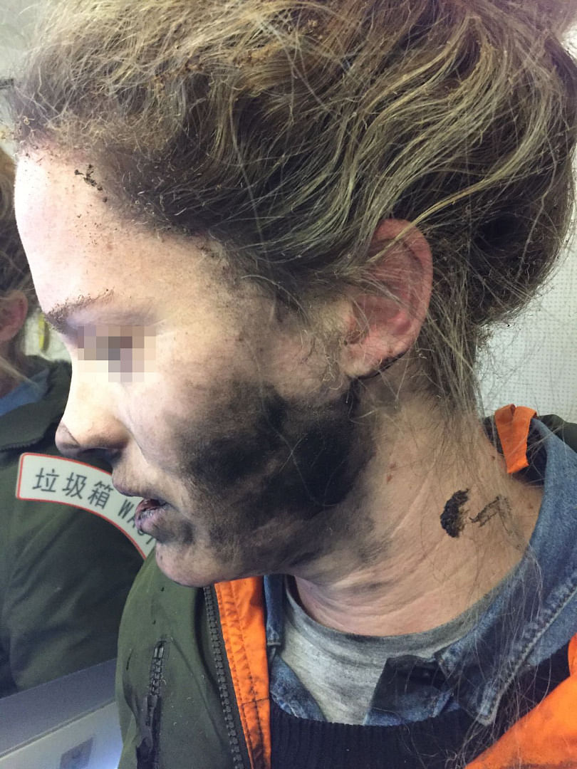 

The batteries in the woman’s headset caught fire while she was flying from Melbourne to Beijing.  