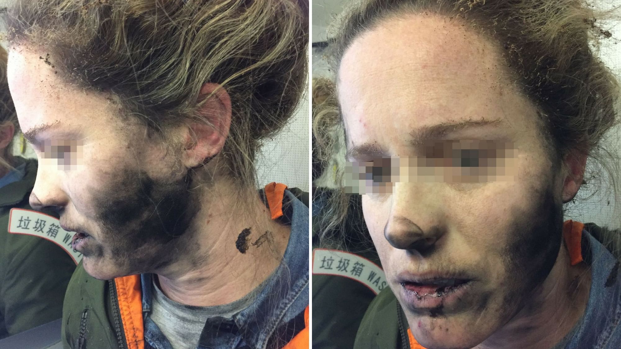 A woman ended up with serious burn injuries on her face while she was listening to music using her battery-operated earphones. (Photo Courtesy: <a href="https://www.atsb.gov.au/newsroom/news-items/2017/battery-explosion-mid-flight/">Australian Transport Safety Bureau</a>/Altered by <b>The Quint</b>)