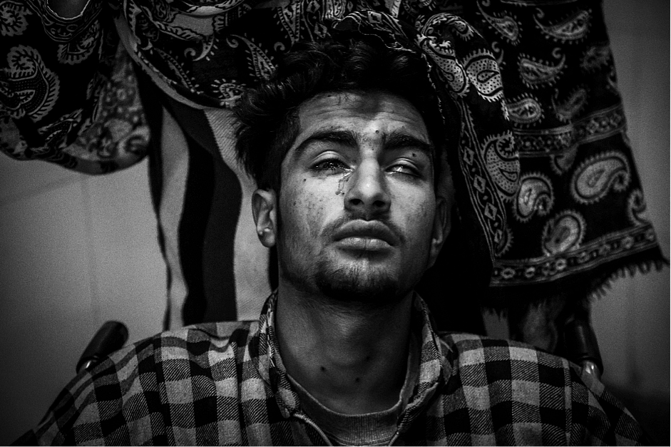 Ishtiyaq, 17, a pellet injury victim, awaits for
medical attention at a hospital in Srinagar. (Photo: Hashim Hakeem)