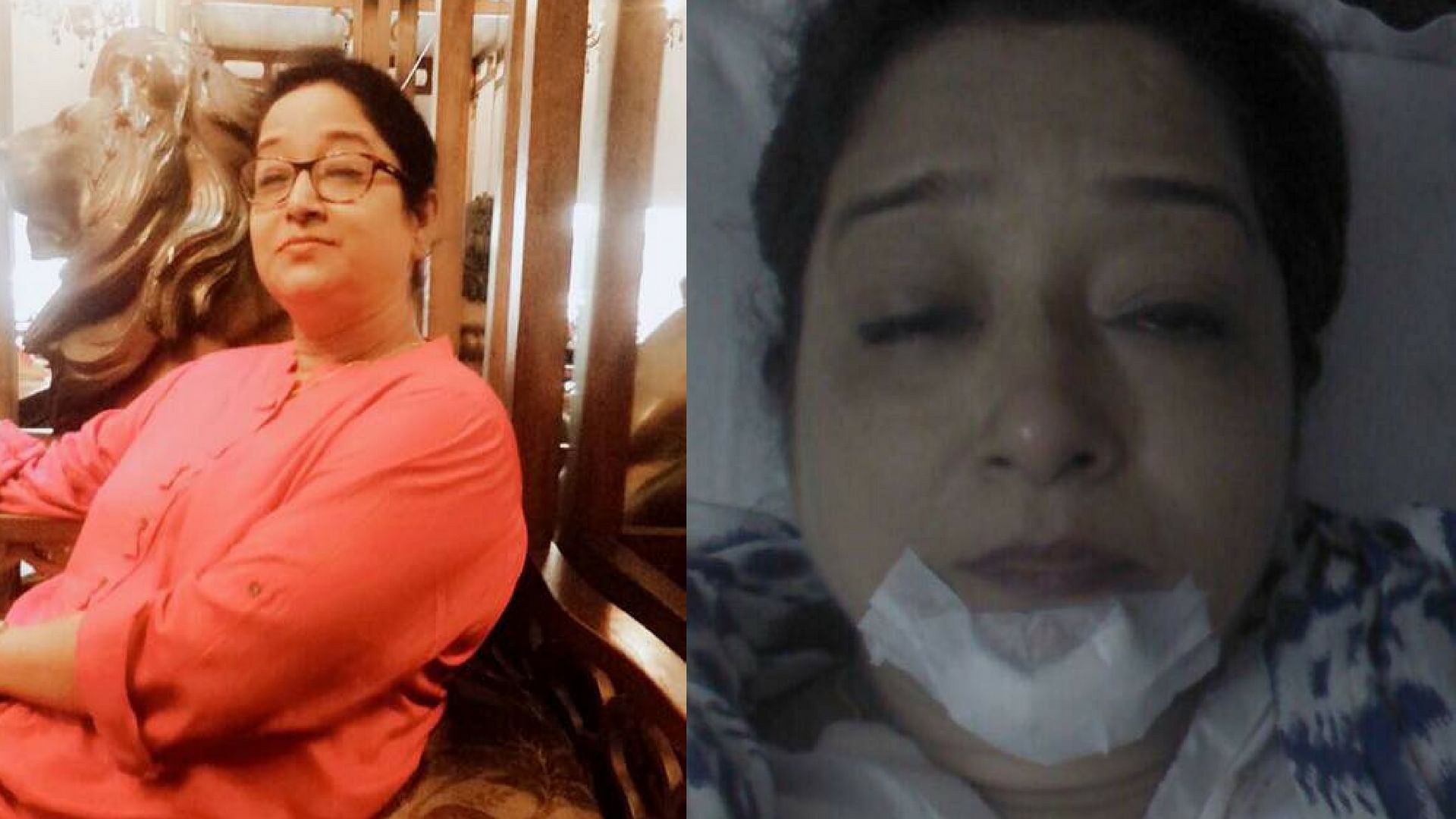 Savita Kaur Bhatia alleges that Jet Airways officials mentally harassed her, causing her to faint and injure herself. (Photo Courtesy: Facebook/<a href="https://www.facebook.com/kawaljit.bhatia/posts/10154421638601437?pnref=story">Kawaljit Singh Bhatia</a>)