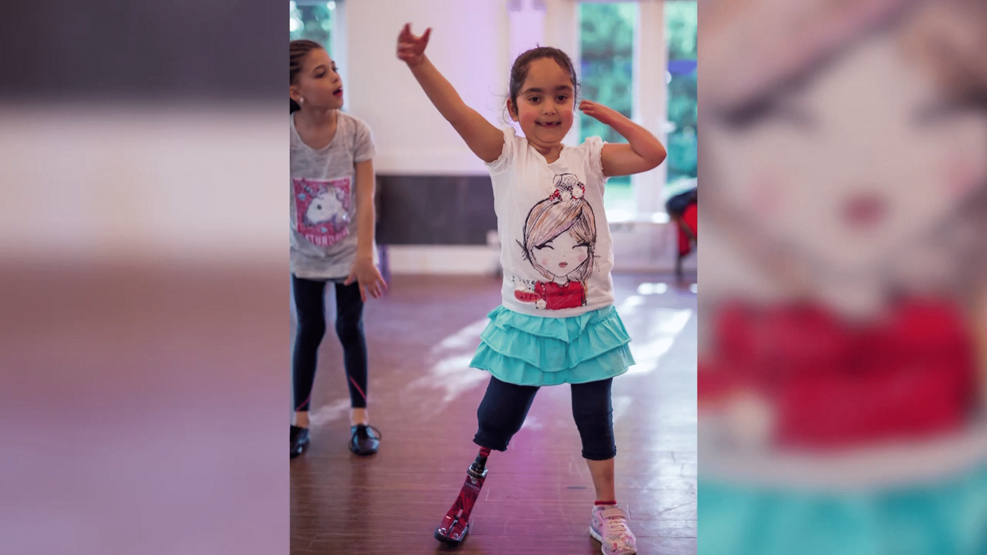 Girl gets a new prosthetic leg (Photo: Ruptly Screengrab)