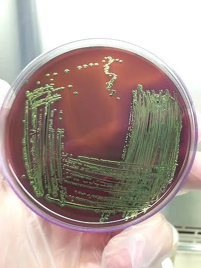 The results revealed that 60 percent of the E.coli bacteria contained ‘resistance conferring’ genes that rendered many antibiotics ineffective. 