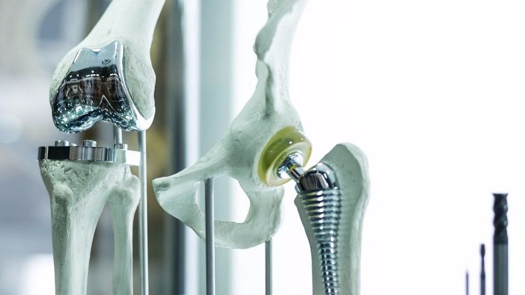 Representational image of knee implants.
