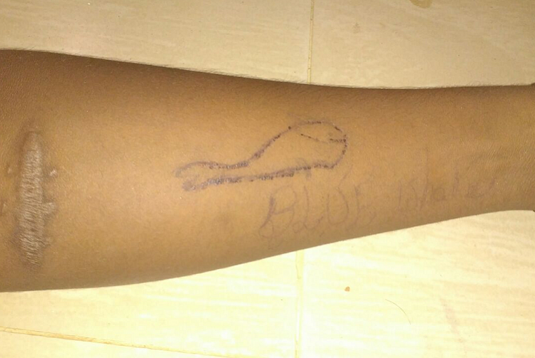 The forearm of the teenager raised suspicion over his involvement in the deadly Blue Whale challenge.