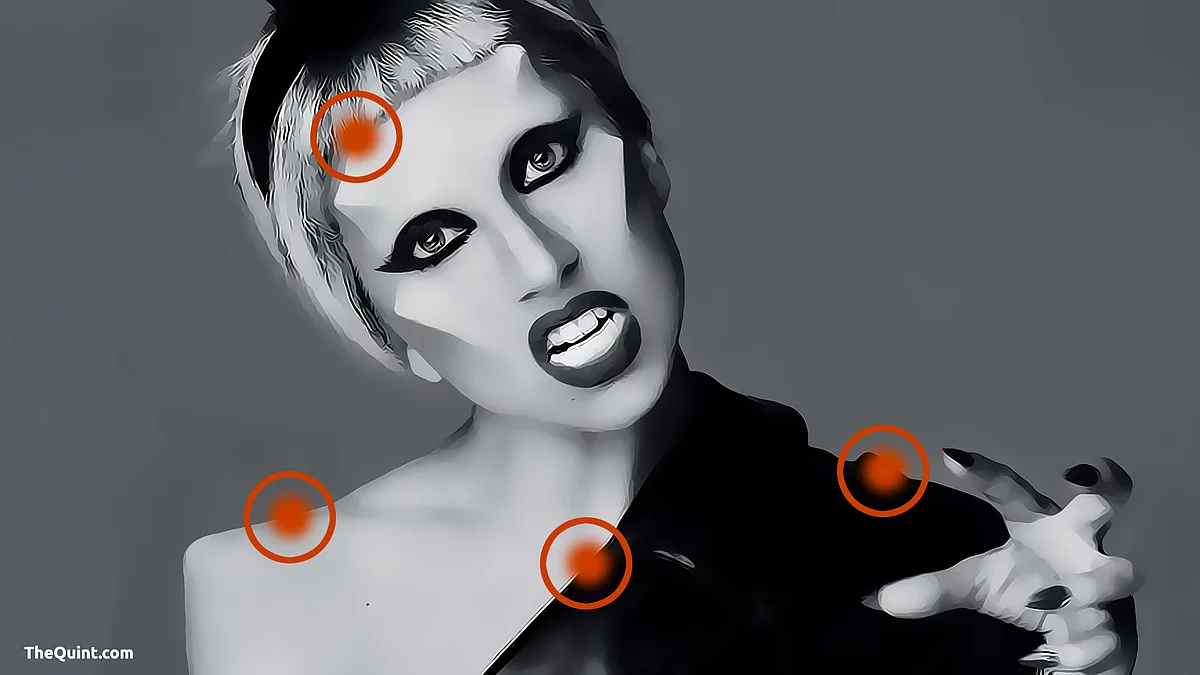 #LetsTalkPain: Our Editor’s Tryst With Fibromyalgia