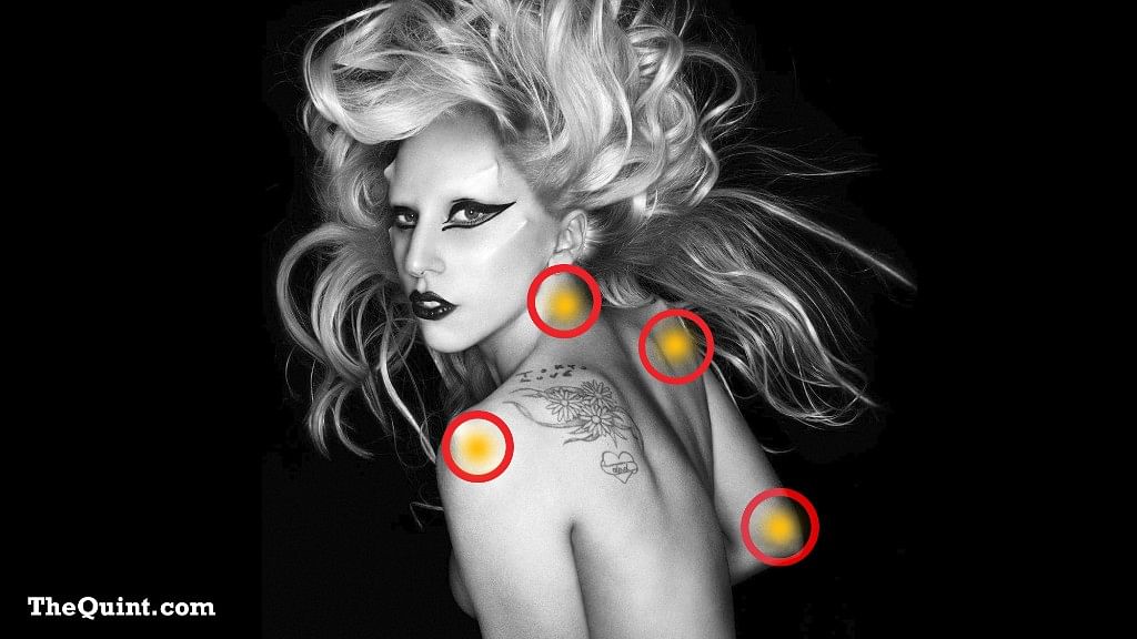 I am delighted that Lady Gaga is creating a Twitter storm over Fibromyalgia.