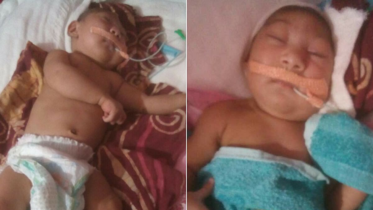 

Doctors say that he cannot survive more than a few days, but the parents continue to hope for a miracle.