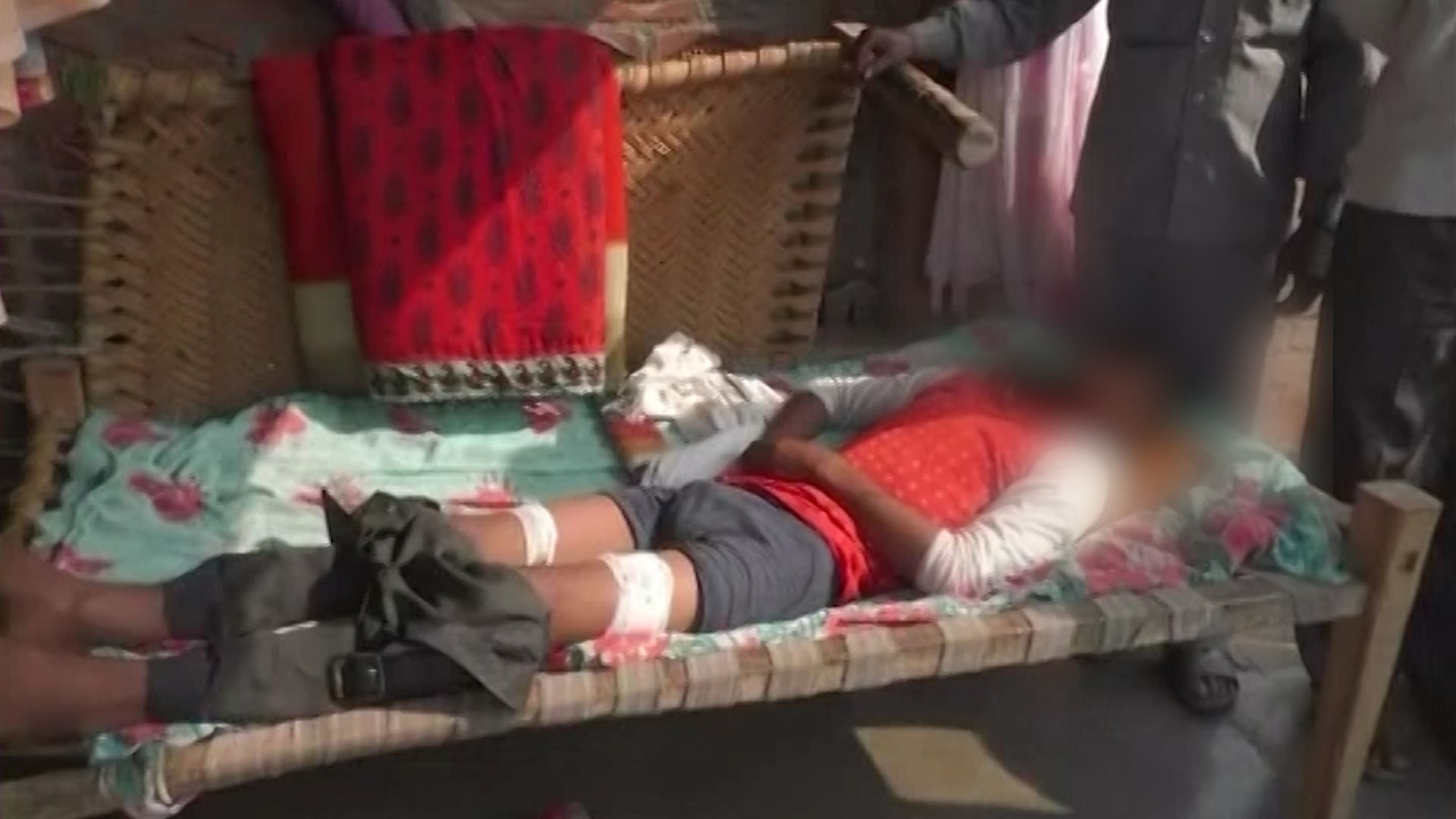 Class 11 Student suffered cuts on both legs