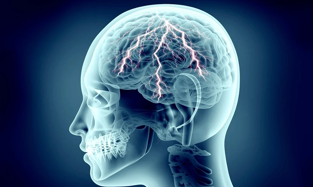 Cure Migraine With Surgery? Not That Simple, Say Docs