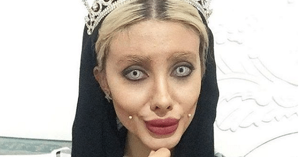 Teen behind viral 'Angelina Jolie' plastic surgery photos reveals she lied, The Independent
