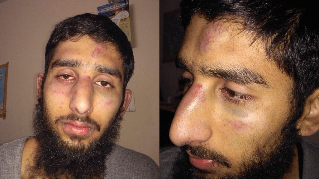 Attack on 2 Kashmiri Students in Haryana Not Targeted, Says Police