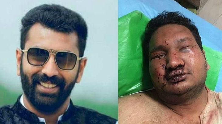 Vidvat L was admitted to the Mallya Hospital in Bengaluru after being assaulted by Mohammed Nalapad, son of Congress MLA NA Haris.