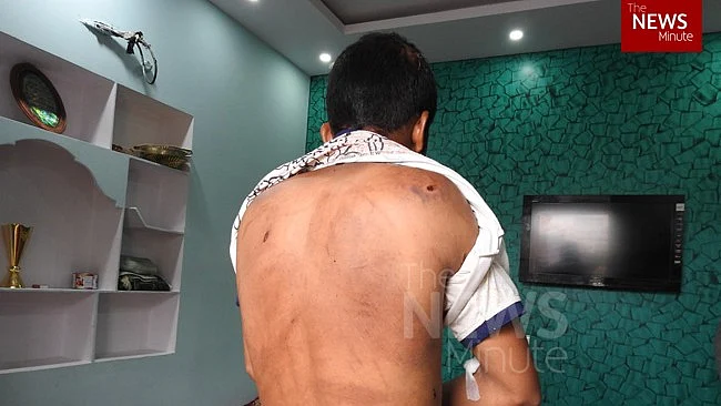 Salman sustained injuries on the back and the head in the attack.