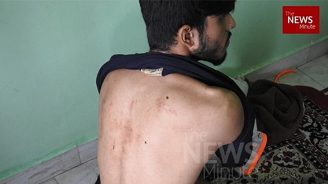 Noor sustained injuries on his back