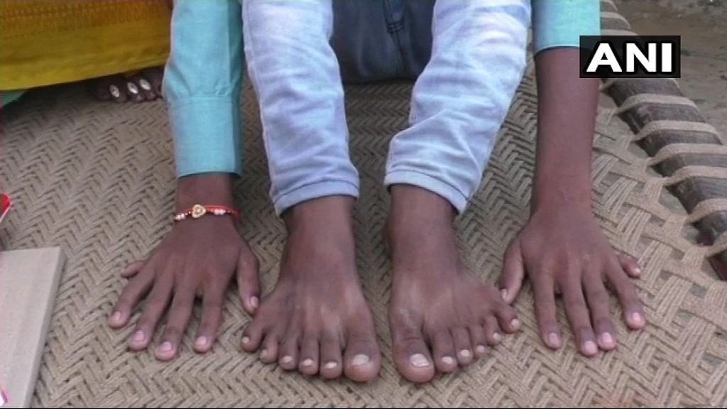 The parents of a boy born with 12 fingers and toes have alleged that his relatives have been trying to kill him.&nbsp;