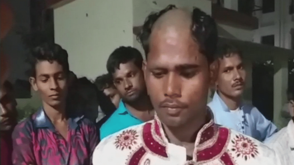 Family members of a bride in Uttar Pradesh’s Lucknow tonsured the groom, his father and brother for allegedly harassing them over dowry.