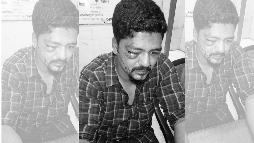 Herman Gomes was attacked by unknown men in the wee hours of Sunday, 14 October.