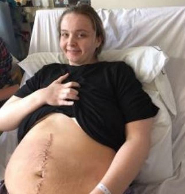 A 26 kg huge ovarian cyst in a woman was confused as pregnancy by doctors, until an ultrasound revealed the truth.