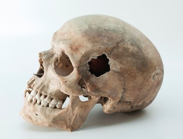 Bone smuggling had been rampant in India for decades, if not centuries. 