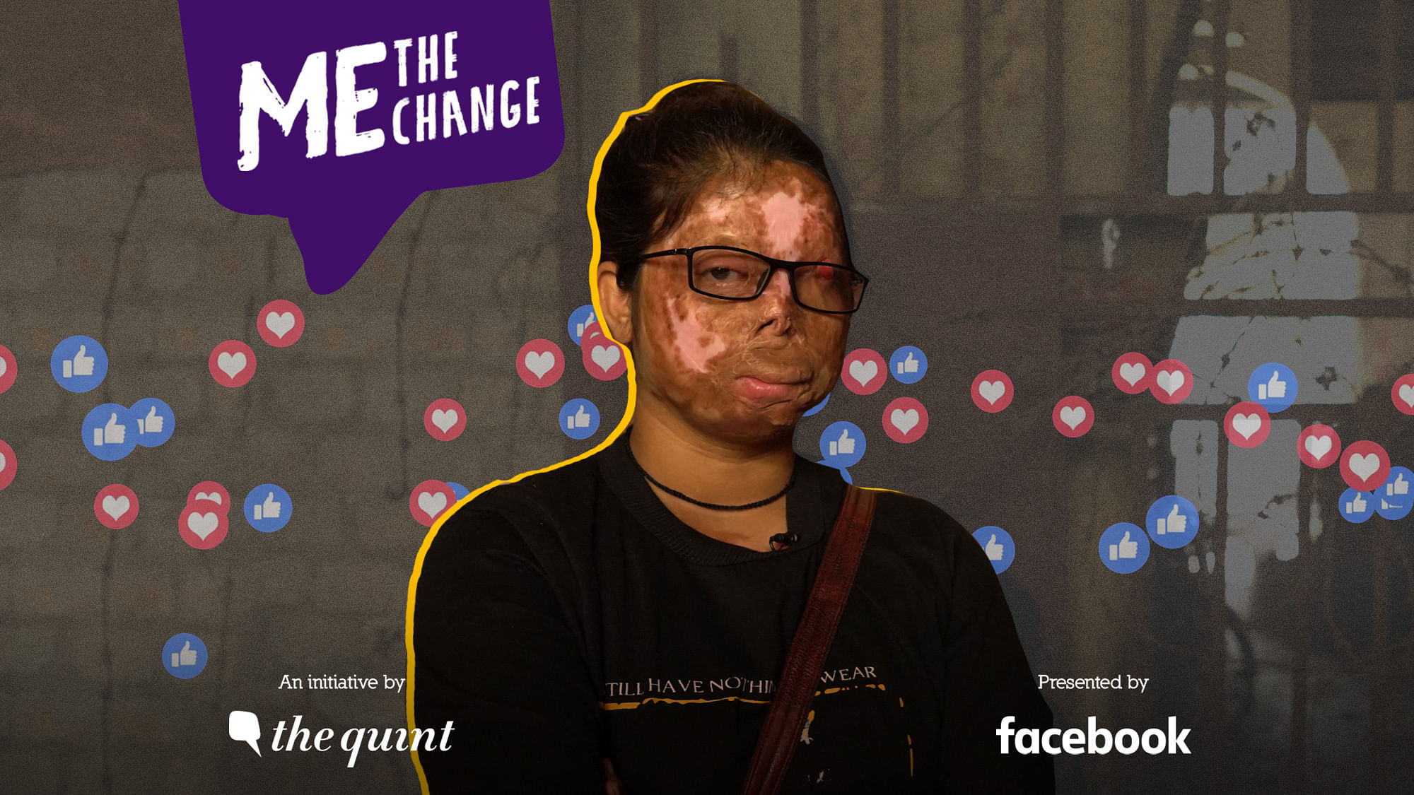Anshu Rajput hasn’t let the acid attack stop her from living her dreams.&nbsp;