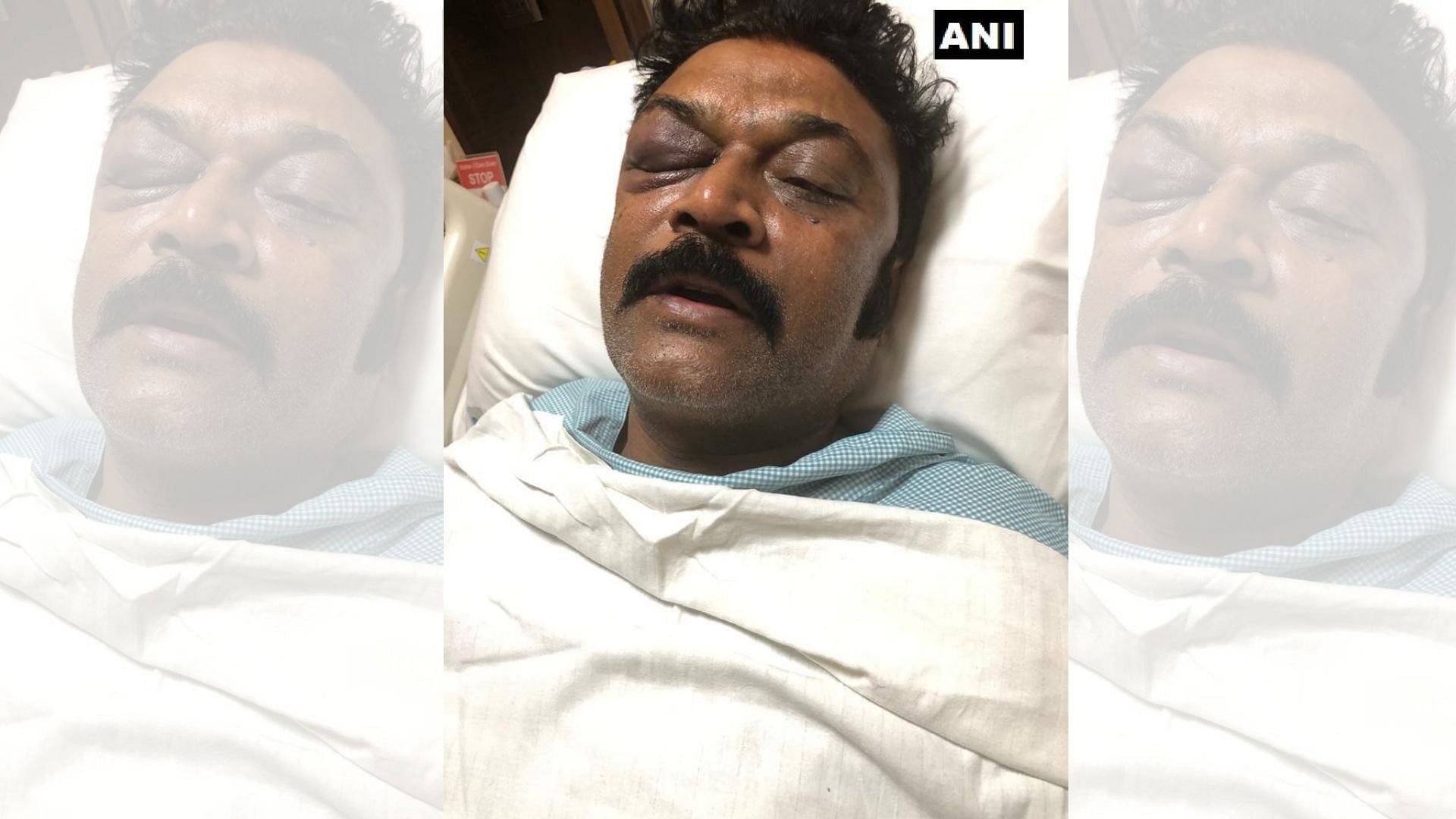 Congress MLA Anand Singh injured in the brawl being treated at Apollo hospital.