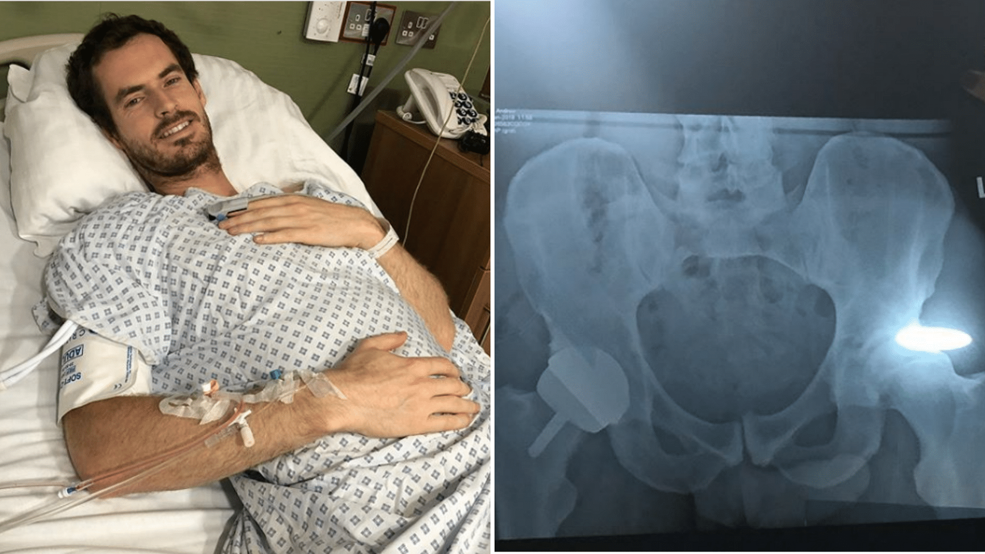 Three-time major winner Andy Murray shared pictures after undergoing a second surgery on his hip in London on 28 January.