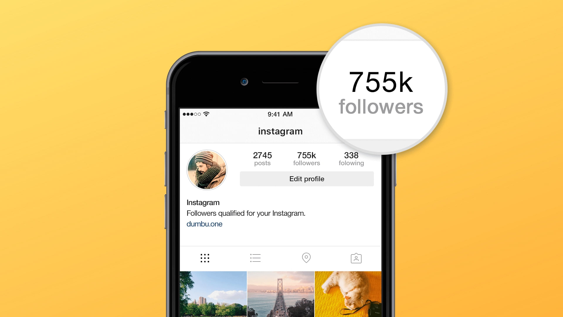 Users on the photo sharing platform have been losing followers and nobody knows why.&nbsp;