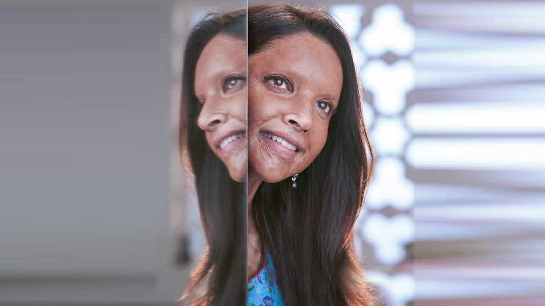 Deepika Padukone plays the role of an acid attack survivor in <i>Chhapaak</i>.