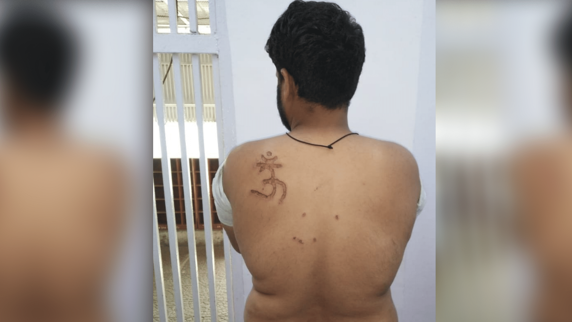 Tihar Prisoner, Nabbir has alleged that the jail Superintendent subjected him to inhuman treatment, deprived him of food and branded the ‘Om’ symbol on his shoulder.