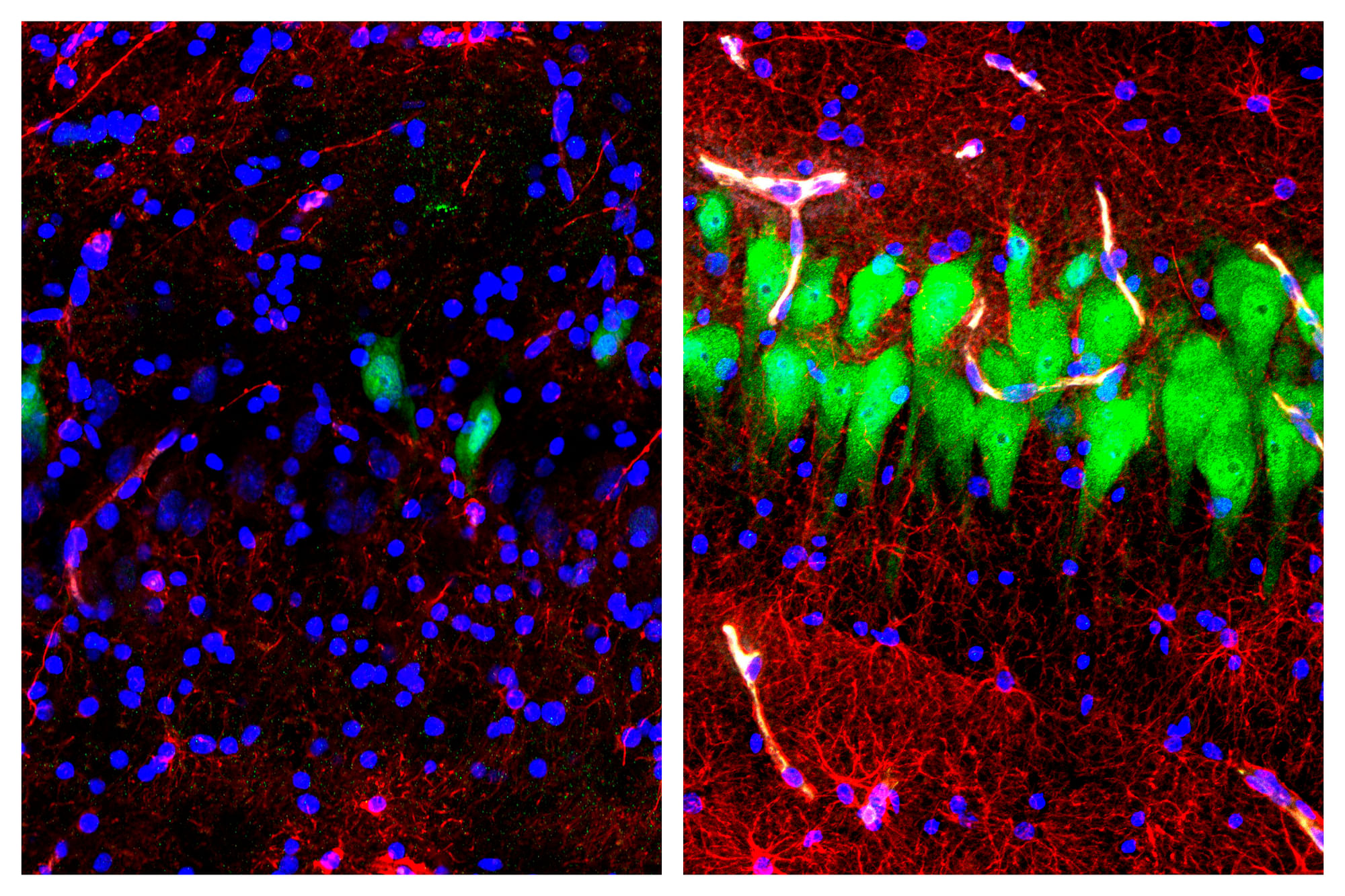Neurons in a dead brain (L), Neurons after being treated (R).