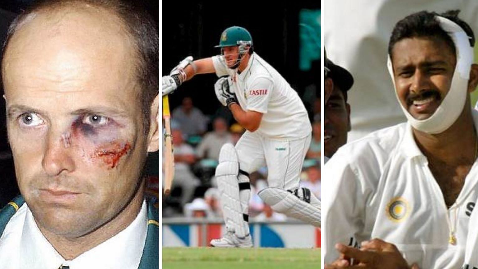 Anil Kumble, Gary Kirsten and Graeme Smith have all played with injuries in their career.