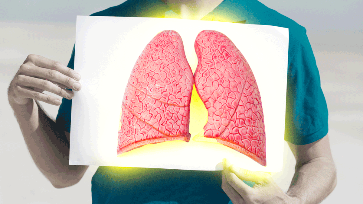 90 percent of lung cancer diagnoses could be prevented if smoking was eradicated.