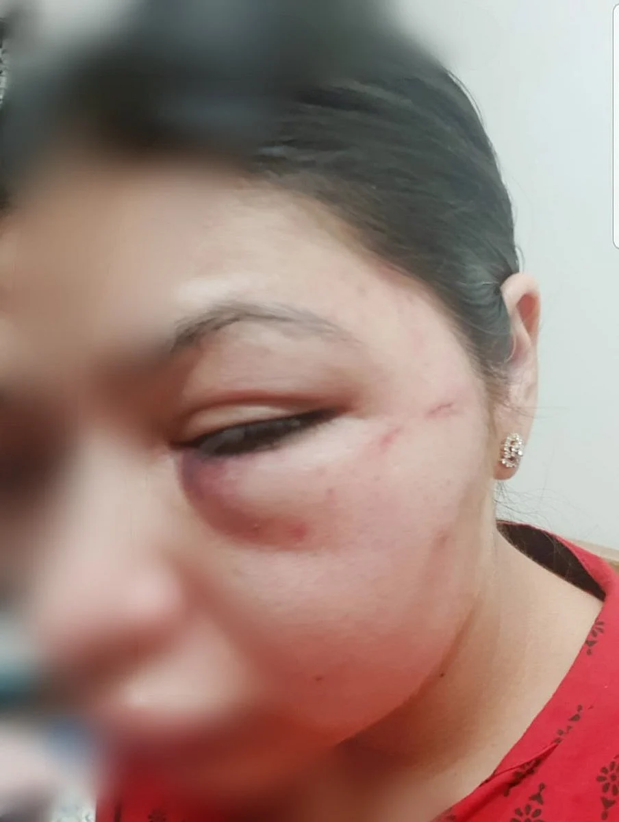 Singh said that the last time she was physically abused was at their Gurugram residence, when she was “physically tortured for hours at a stretch.”