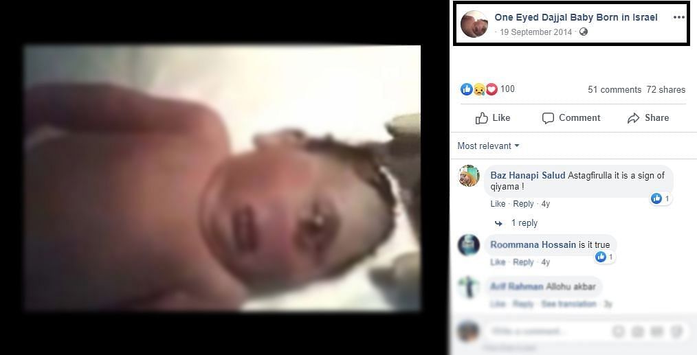 One Eye Dajjal Baby  Born in Israel Viral Video Fact Check 