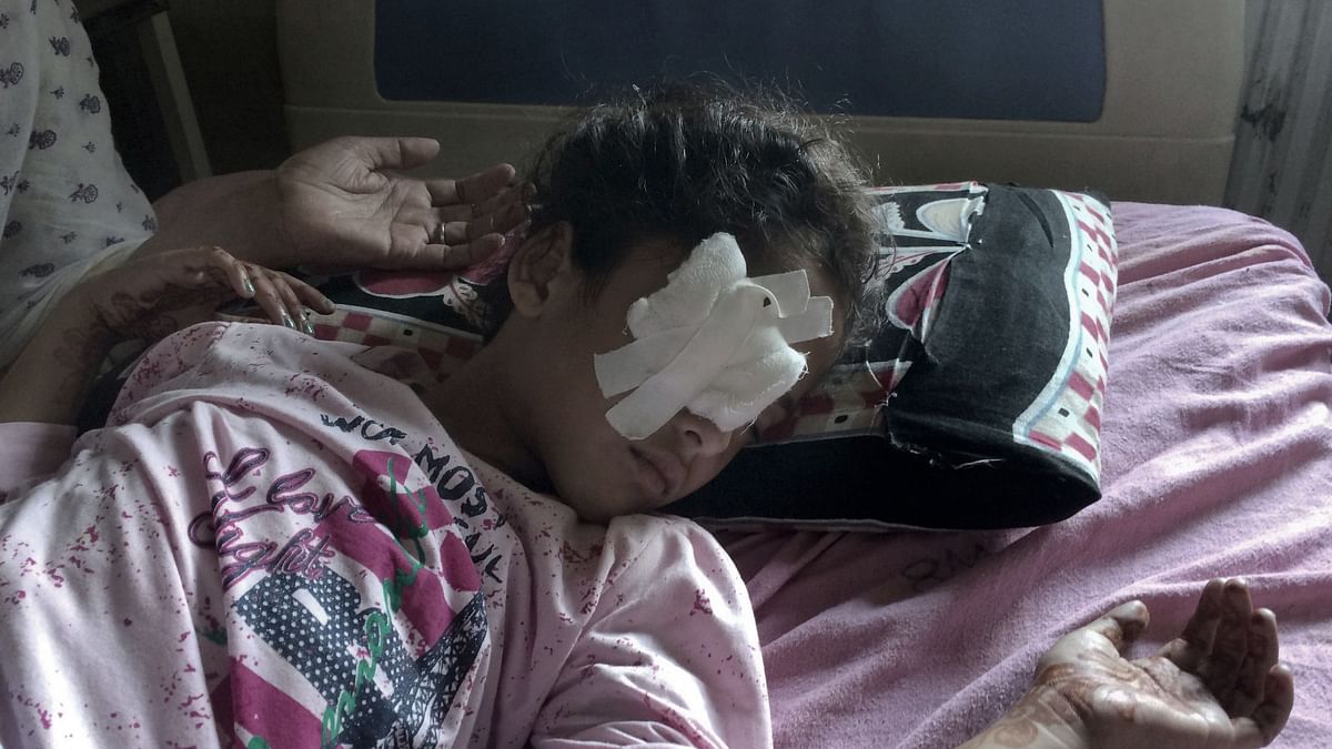 A 6-yr-old wounded Kashmiri girl, Muneefa Nazir, at a hospital in Srinagar. Image used for representational purposes.