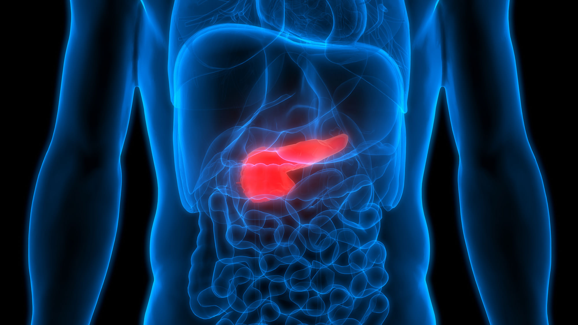 According to the study, incidence rates for colorectal and pancreatic cancer both increased by 10 per cent between 1990 and 2017