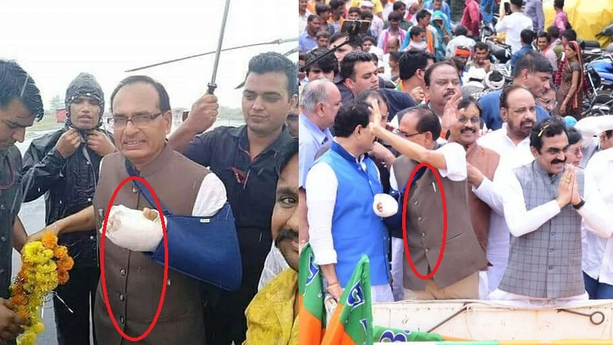 Comparison of photos displaying opposite button alignment on Chouhan’s jacket.