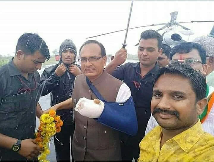 Shivraj Chouhan Didn’t Fake Arm Fracture, the Image Is Flipped